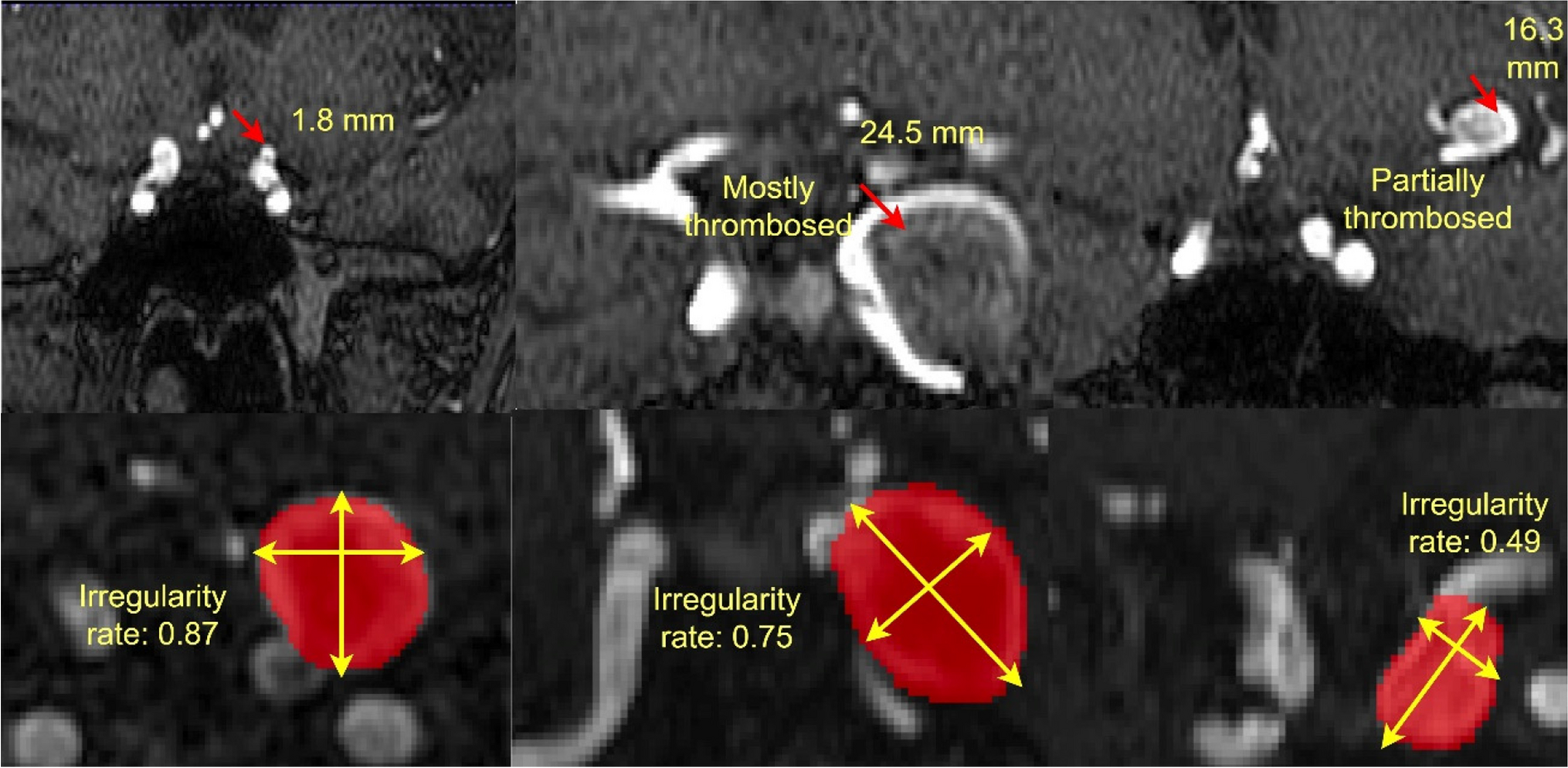 Morphology and Texture-Guided Deep Neural Network for Intracranial Aneurysm Segmentation in 3D TOF-MRA
