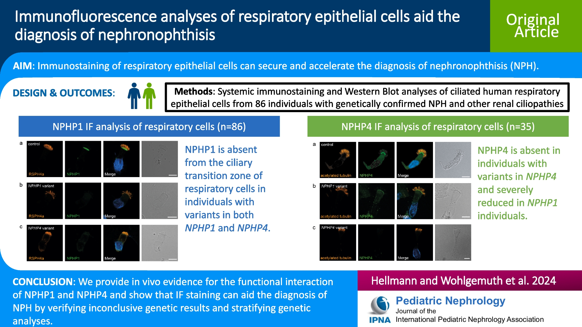 Immunofluorescence analyses of respiratory epithelial cells aid the diagnosis of nephronophthisis