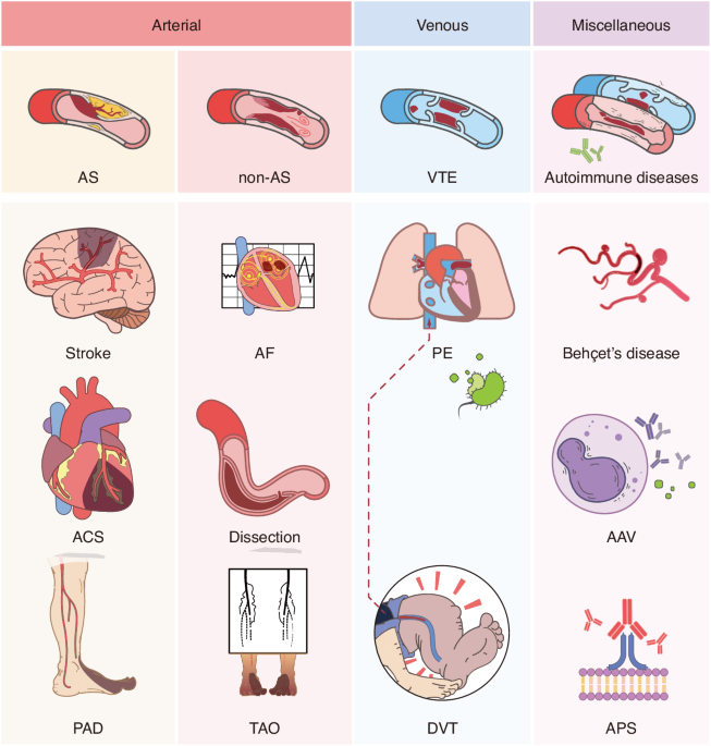 Periodontitis impacts on thrombotic diseases: from clinical aspect to future therapeutic approaches