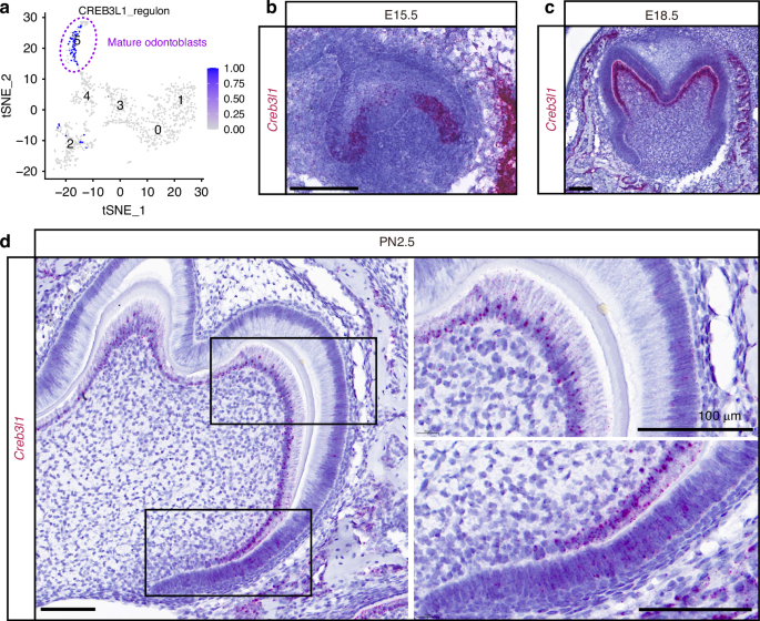 CREB3L1 deficiency impairs odontoblastic differentiation and molar dentin deposition partially through the TMEM30B