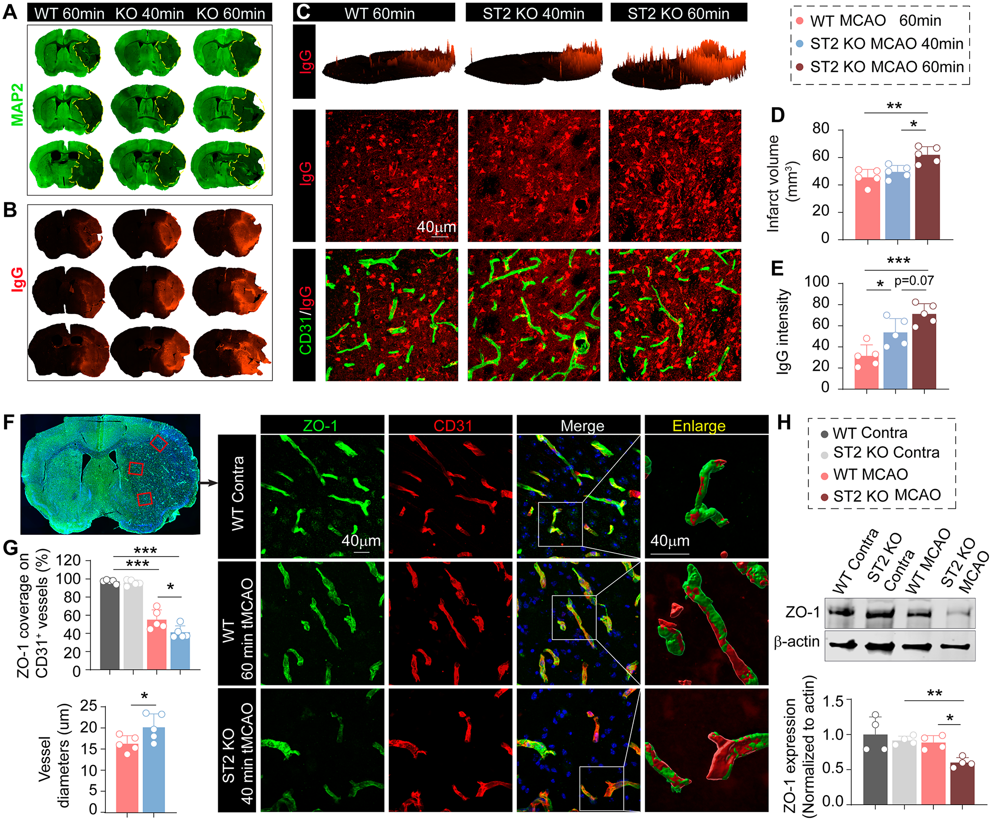 IL-33/ST2 signaling in monocyte-derived macrophages maintains blood-brain barrier integrity and restricts infarctions early after ischemic stroke