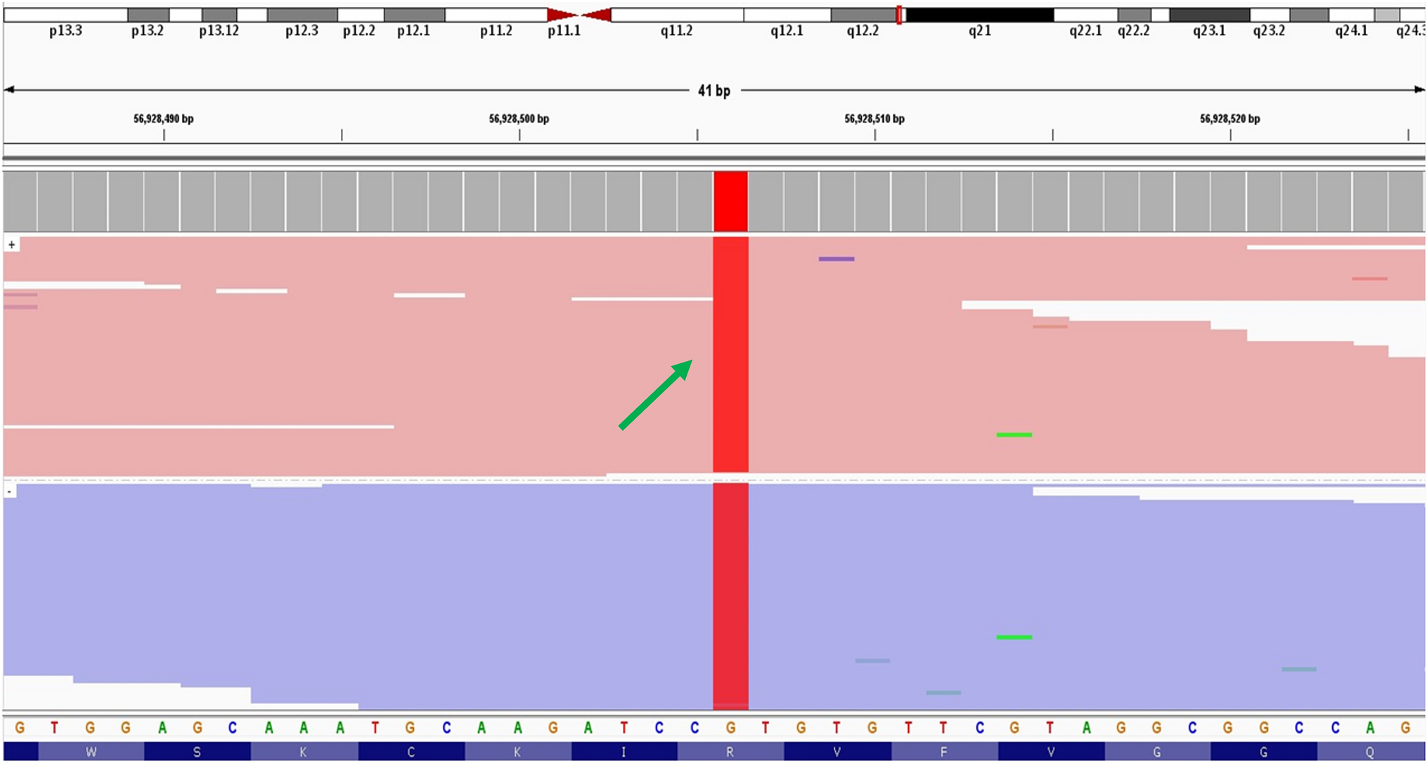 A novel homozygous SLC12A3 mutation causing Gitelman syndrome with co-existent autoimmune thyroiditis: a case report and review of the literature