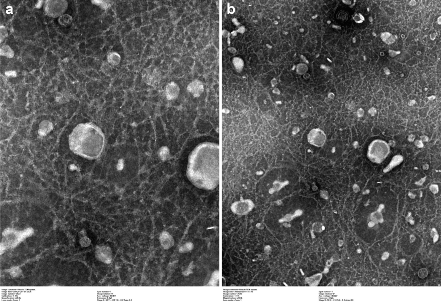 Mesenchymal Stromal Cell Exosome-Induced Vascular Regeneration in a PCOS Mouse Model