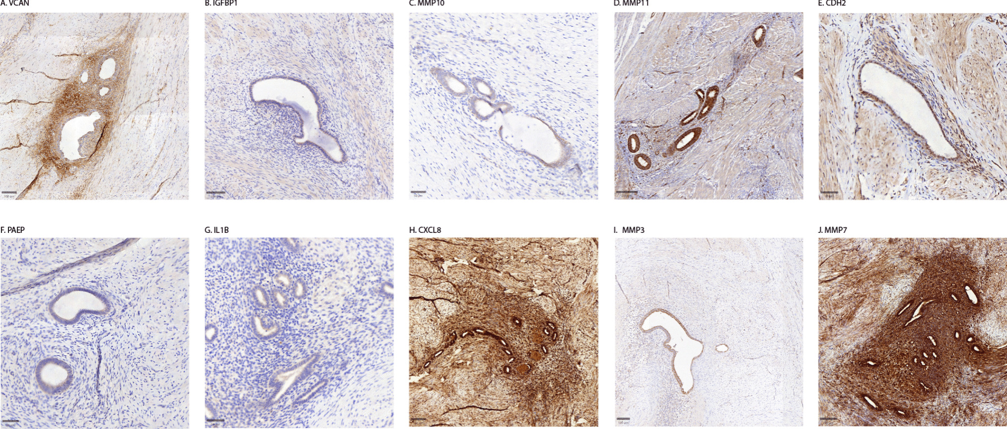 Immunohistochemical Evaluation of Potential Biomarkers for Targeted Intraoperative Fluorescence Imaging in Endometriosis: Towards Optimizing Surgical Treatment