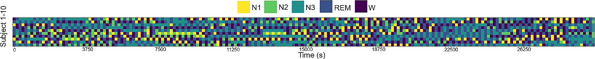 Study on the classification of sleep stages in EEG signals based on DoubleLinkSleepCLNet