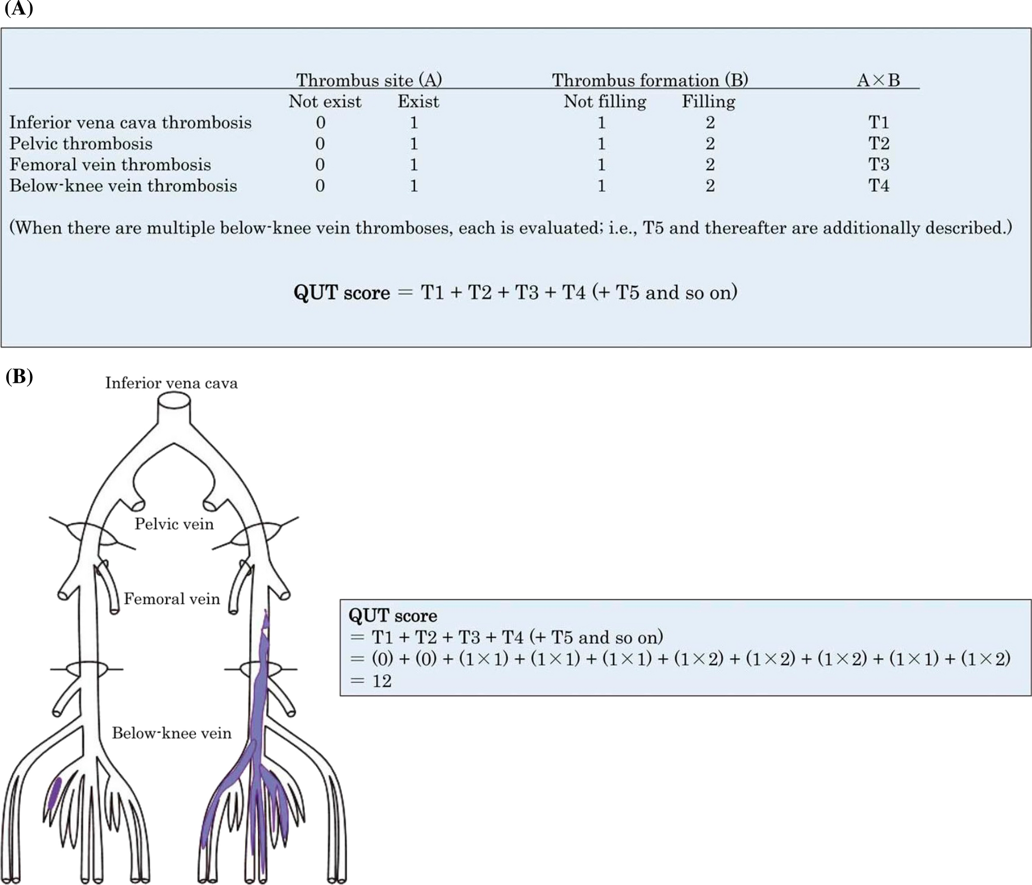 Evaluation of acute thrombus regression effect of edoxaban for deep vein thrombosis in patients with cancer: a single-center prospective observational study
