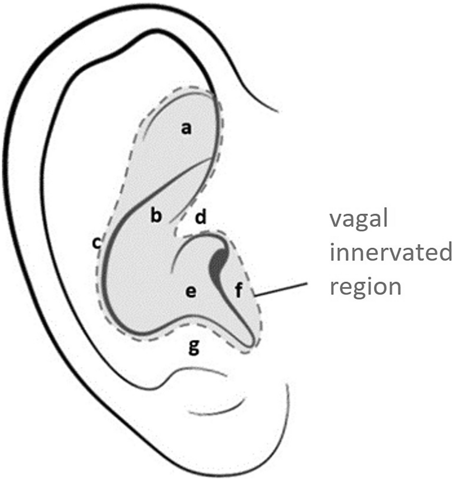 Clinical Efficacy of Auricular Vagus Nerve Stimulation in the Treatment of Chronic and Acute Pain: A Systematic Review and Meta-analysis