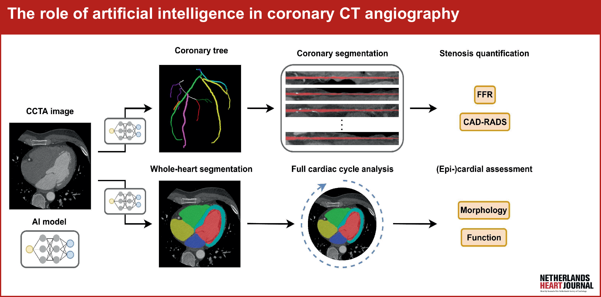 The role of artificial intelligence in coronary CT angiography