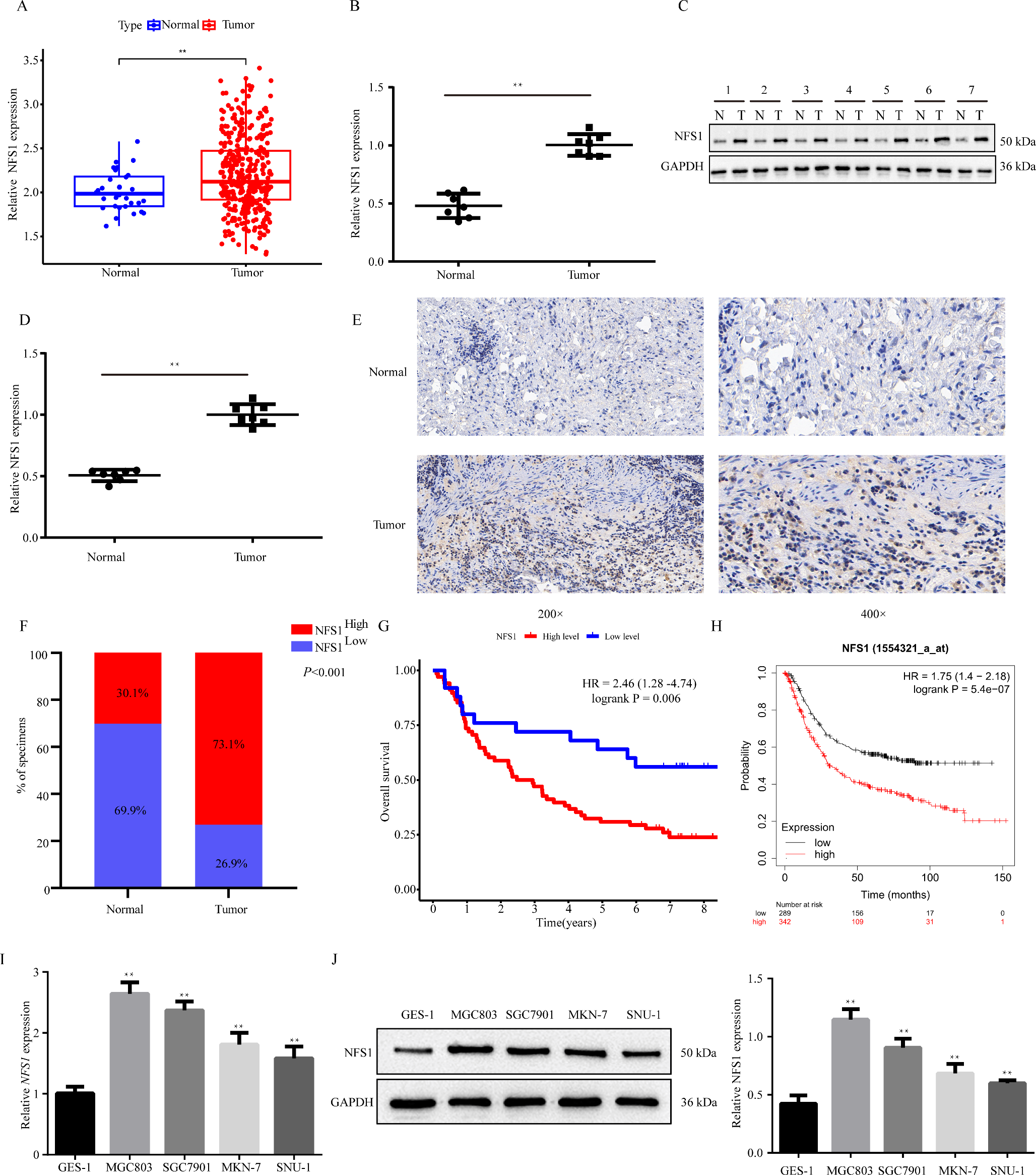 NFS1 inhibits ferroptosis in gastric cancer by regulating the STAT3 pathway