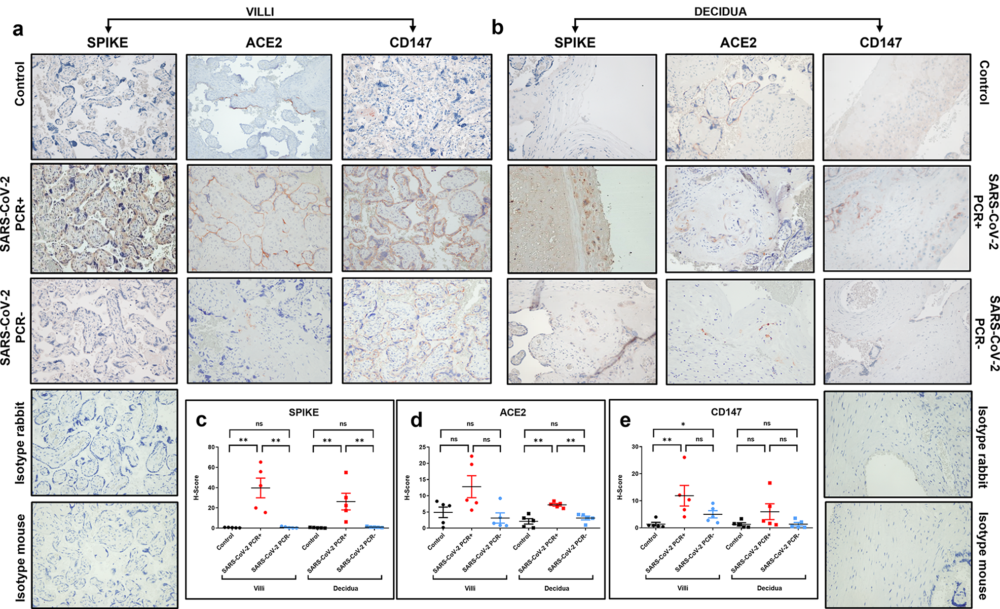 Effects of SARS-COV-2 on molecules involved in vascularization and autophagy in placenta tissues