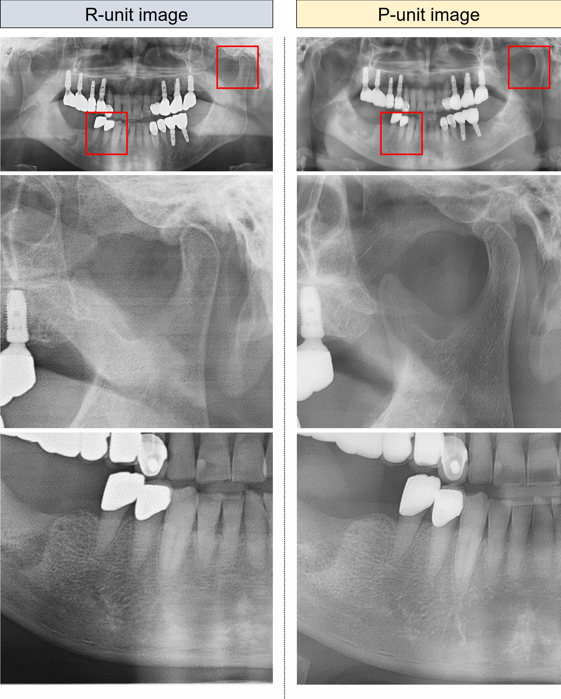Style harmonization of panoramic radiography using deep learning