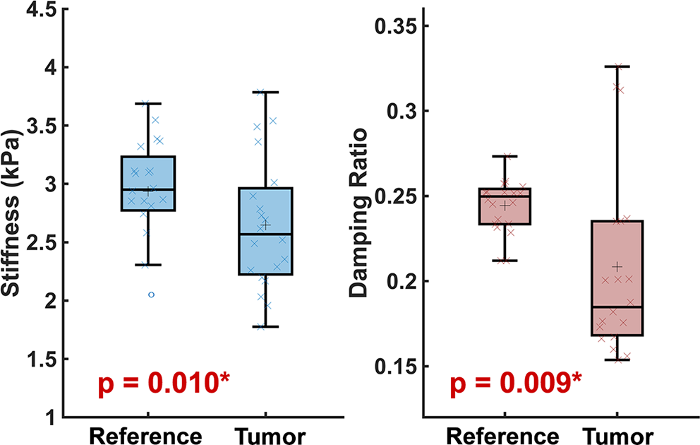 Mechanical properties of pediatric low-grade gliomas in children with and without neurofibromatosis type 1