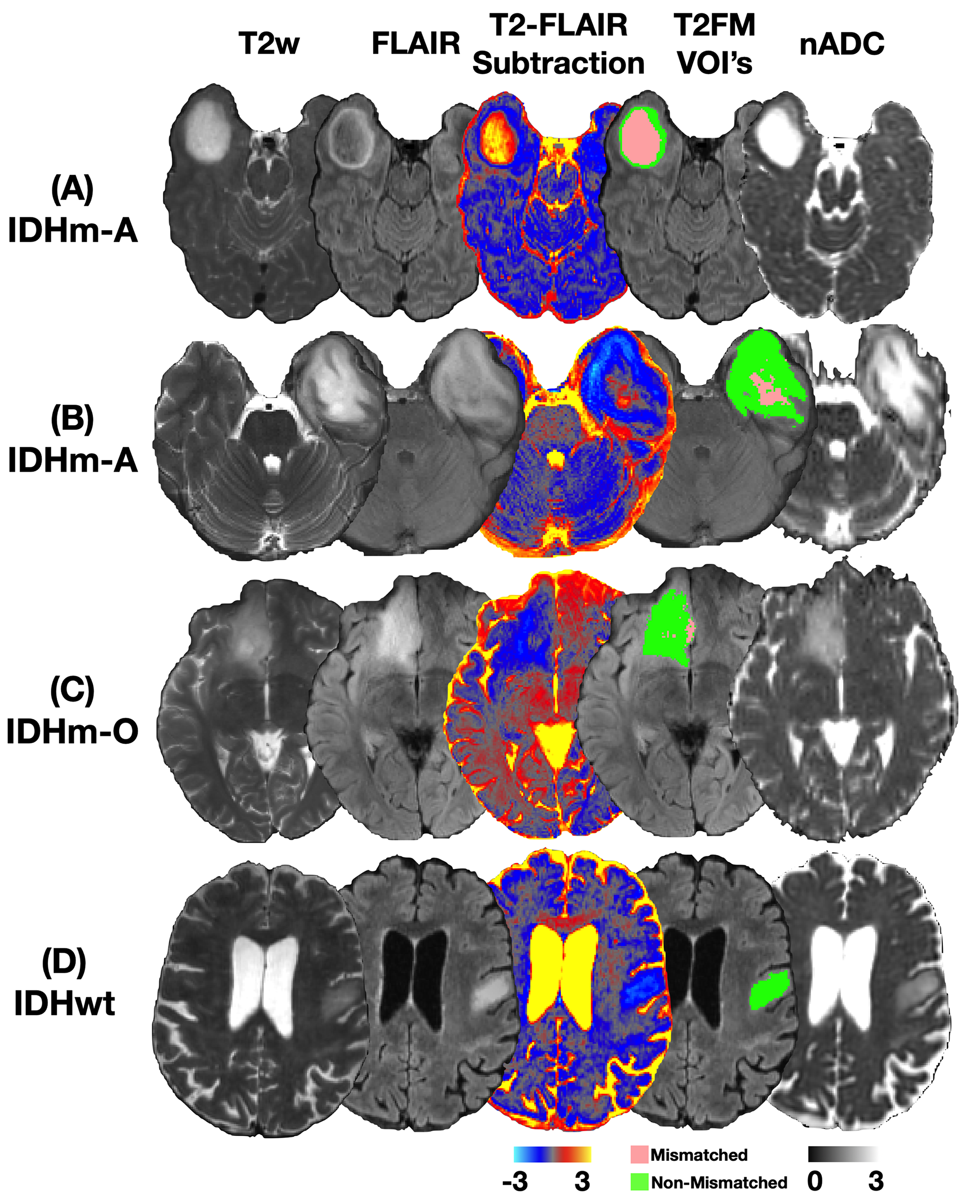 Diffusion MRI is superior to quantitative T2-FLAIR mismatch in predicting molecular subtypes of human non-enhancing gliomas