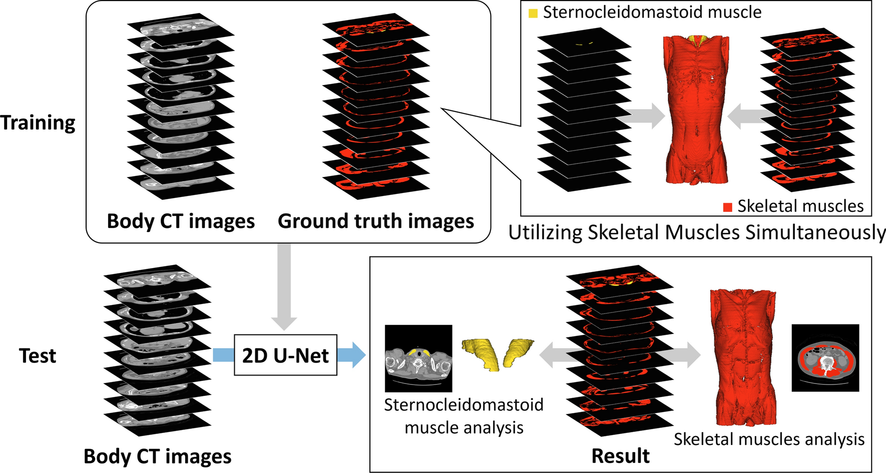 Joint segmentation of sternocleidomastoid and skeletal muscles in computed tomography images using a multiclass learning approach