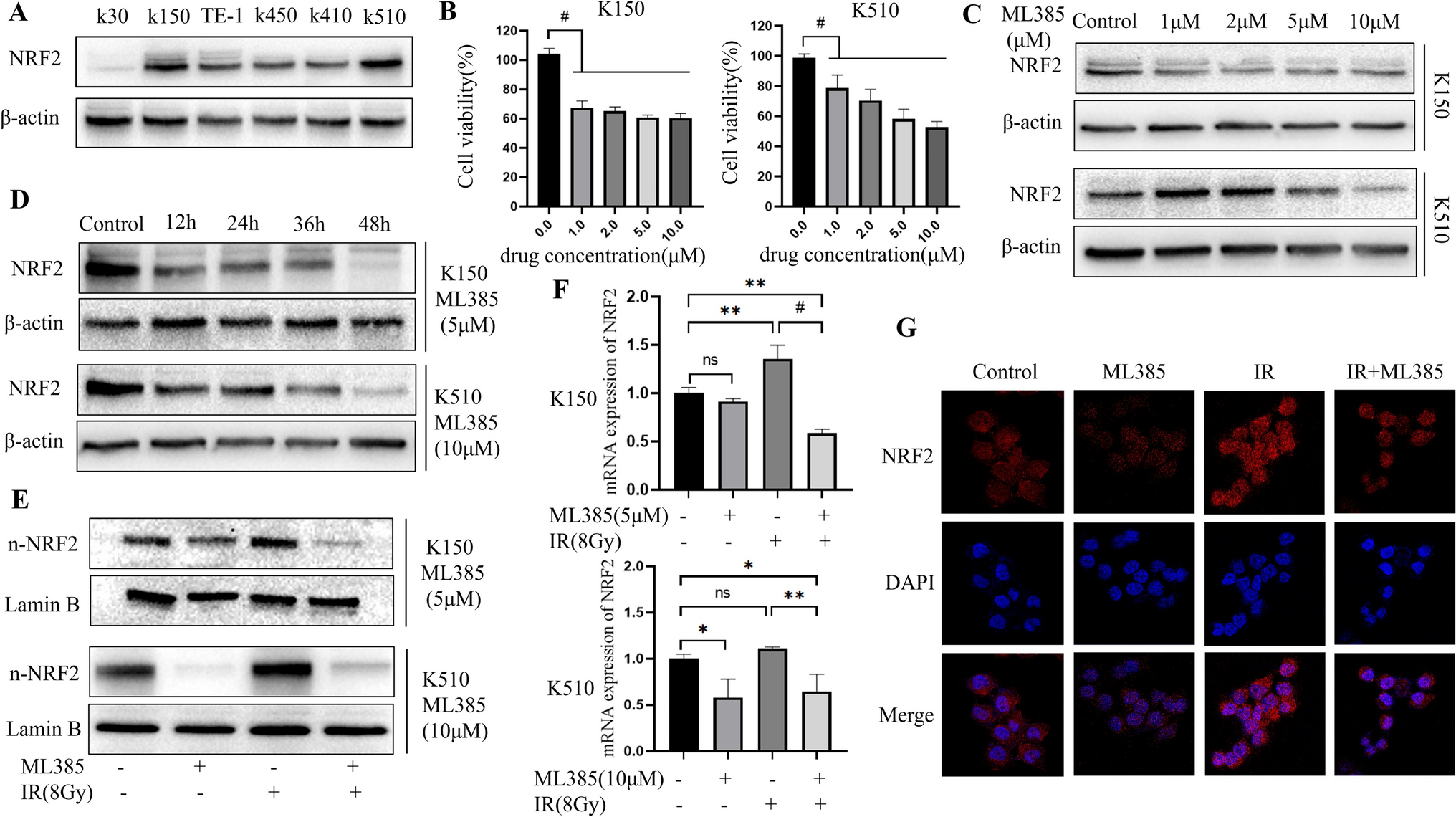 ML385 promotes ferroptosis and radiotherapy sensitivity by inhibiting the NRF2-SLC7A11 pathway in esophageal squamous cell carcinoma