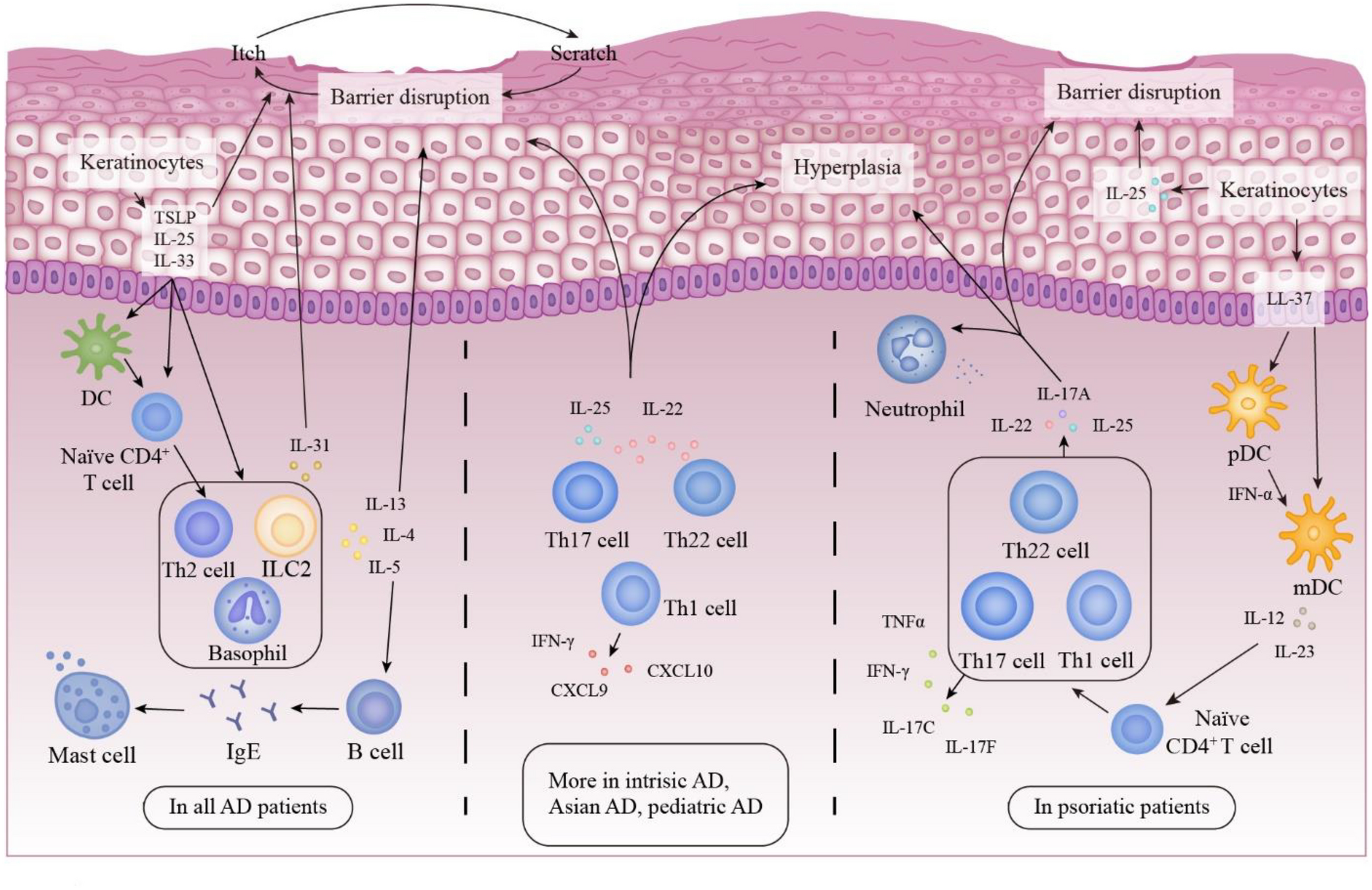 Atopic Dermatitis and Psoriasis: Similarities and Differences in Metabolism and Microbiome
