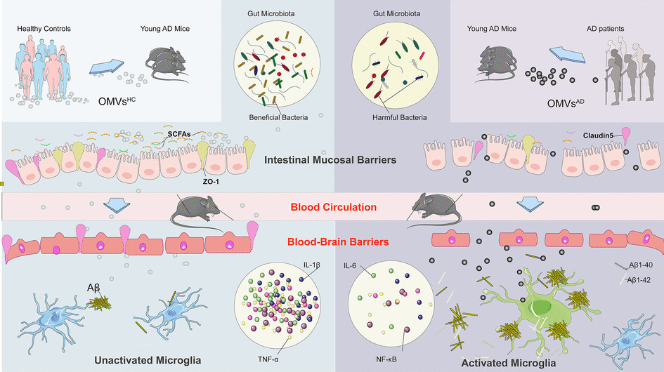 Alzheimer’s Disease-Derived Outer Membrane Vesicles Exacerbate Cognitive Dysfunction, Modulate the Gut Microbiome, and Increase Neuroinflammation and Amyloid-β Production
