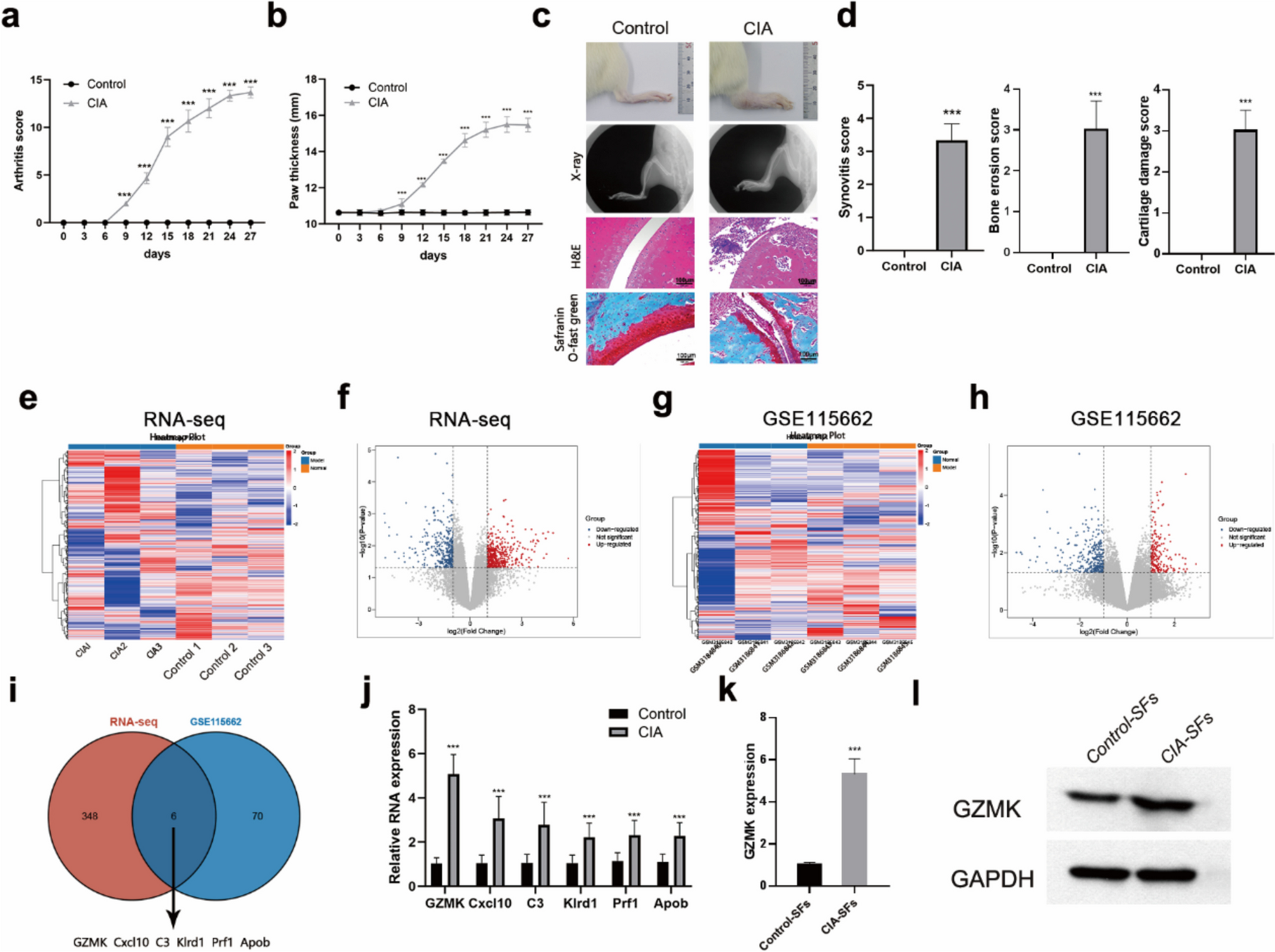 GZMK Facilitates Experimental Rheumatoid Arthritis Progression by Interacting with CCL5 and Activating the ERK Signaling