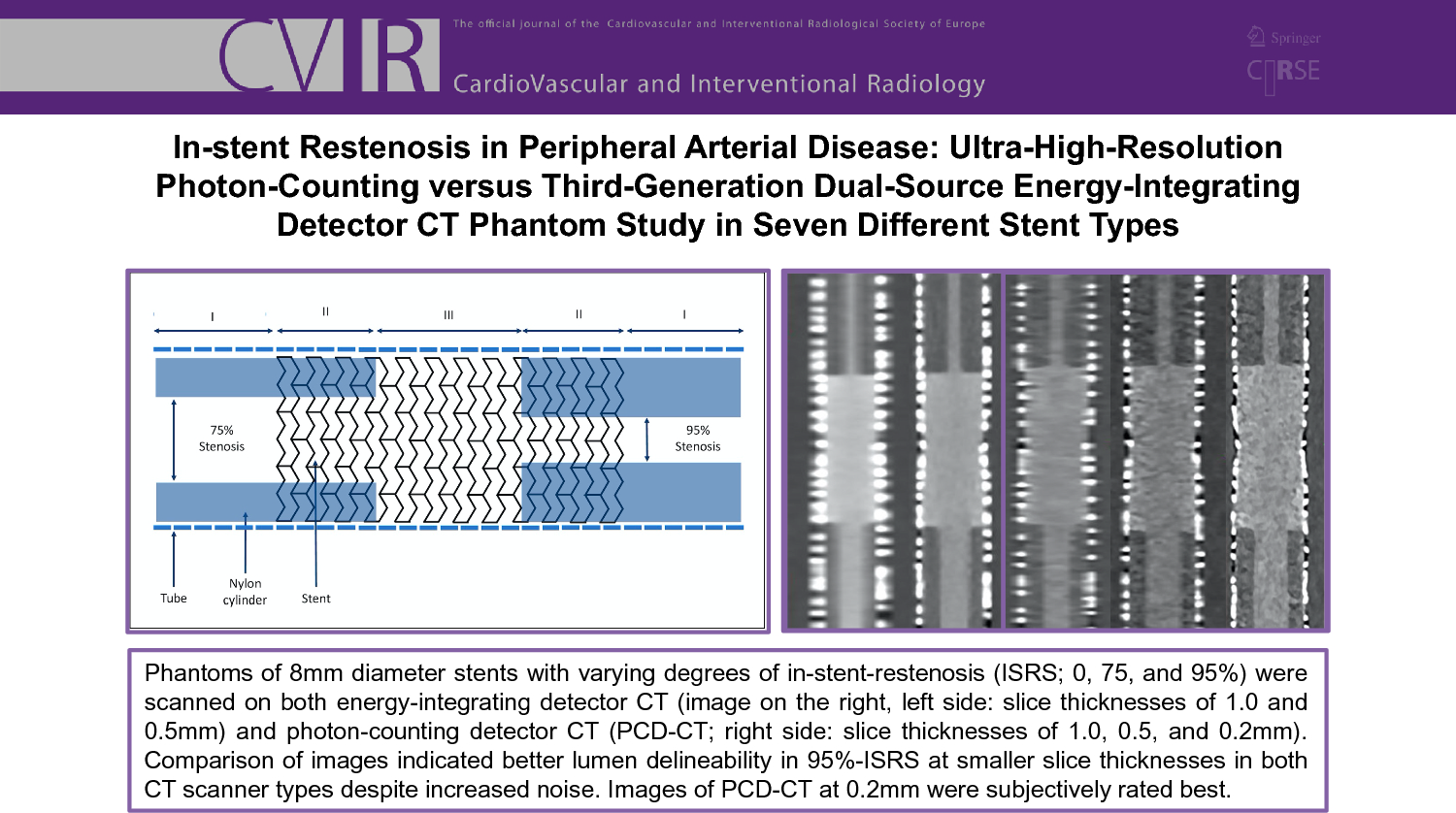 In-Stent Restenosis in Peripheral Arterial Disease: Ultra-High-Resolution Photon-Counting Versus Third-Generation Dual-Source Energy-Integrating Detector CT Phantom Study in Seven Different Stent Types