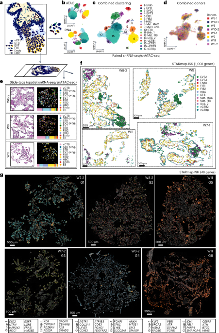 Spatial multiomic landscape of the human placenta at molecular resolution