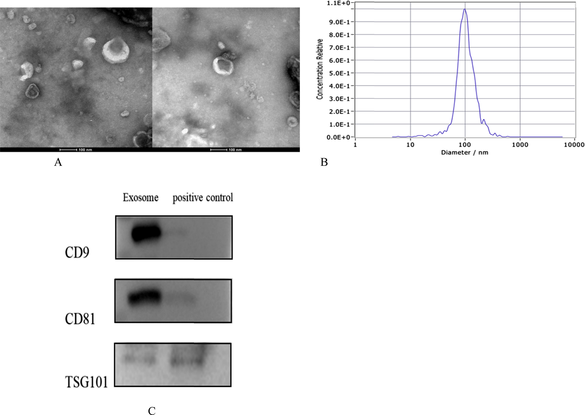 Proteomic analysis of plasma exosomes in patients with metastatic colorectal cancer