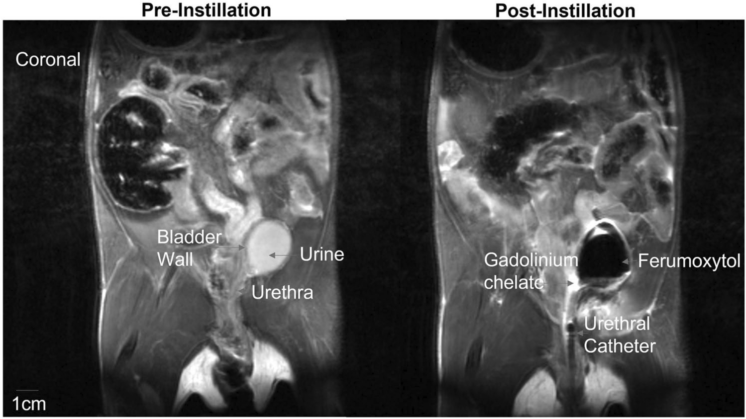 Correction: Treating Lower Urinary Tract Symptoms in Older Adults: Intravesical Options