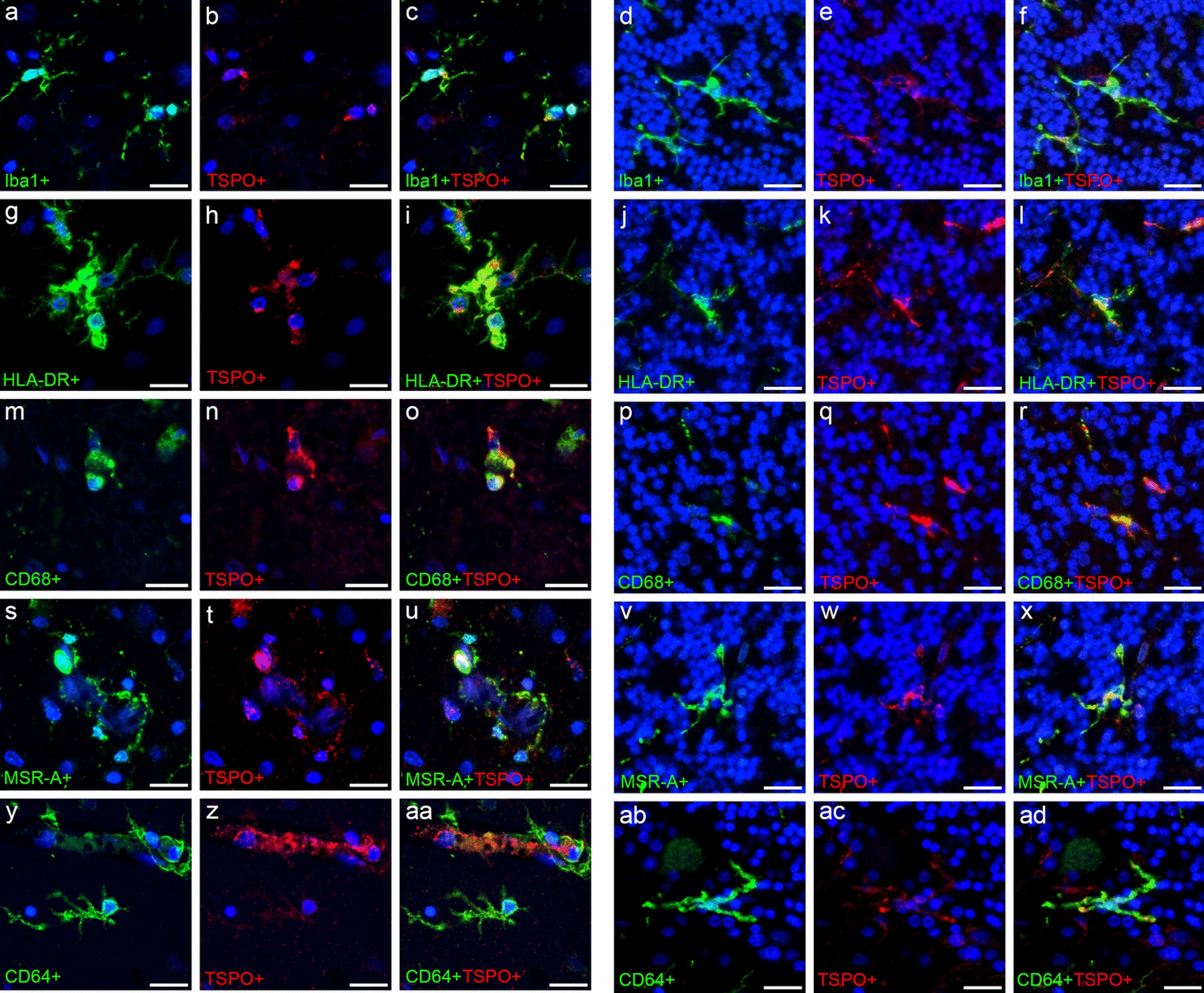 The microglial translocator protein (TSPO) in Alzheimer’s disease reflects a phagocytic phenotype
