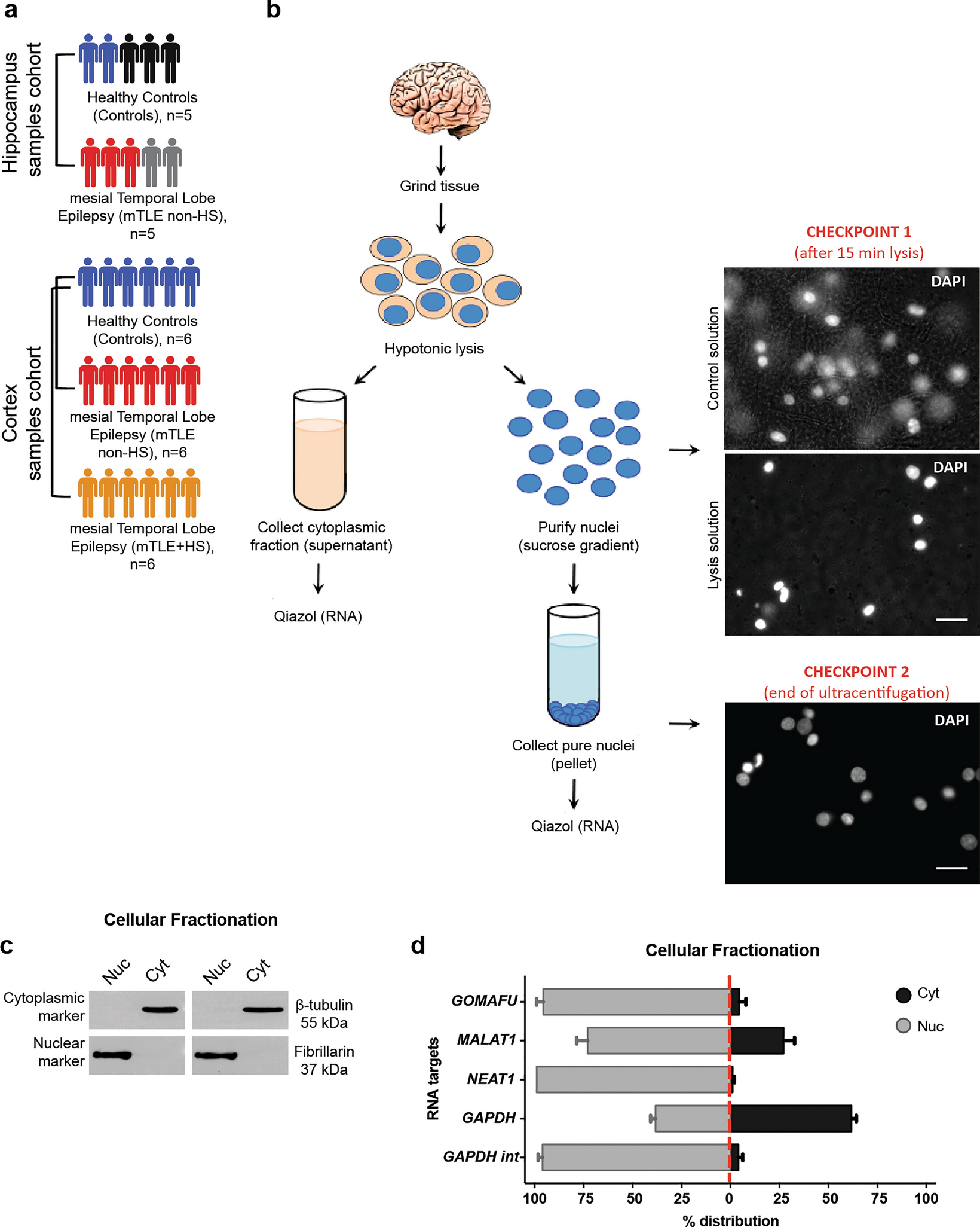 Compartment-specific small non-coding RNA changes and nucleolar defects in human mesial temporal lobe epilepsy
