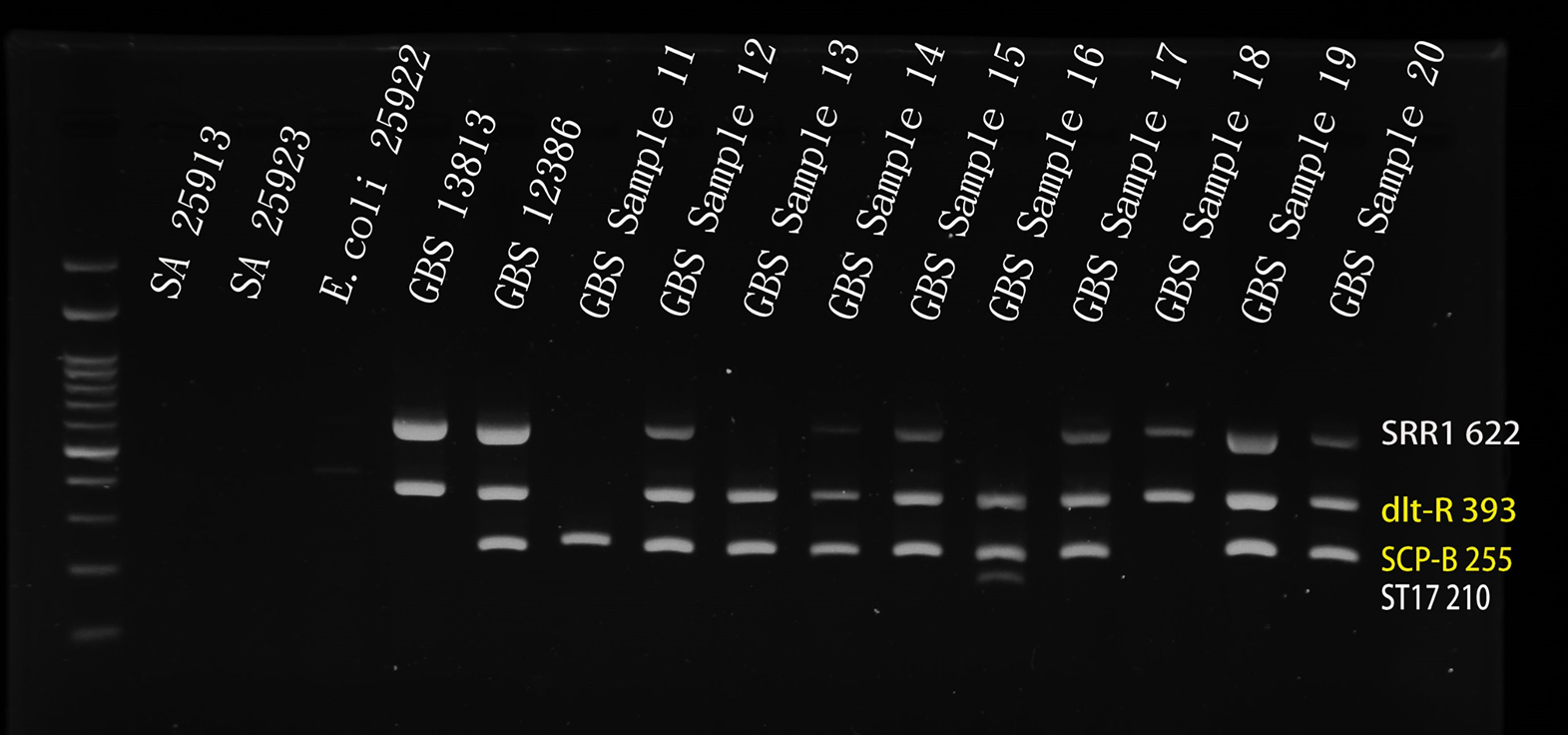 Analysis of serotype distribution and characteristics of nonhemolytic and nonpigmented strains among group B Streptococcus isolates in a southern Taiwan local hospital