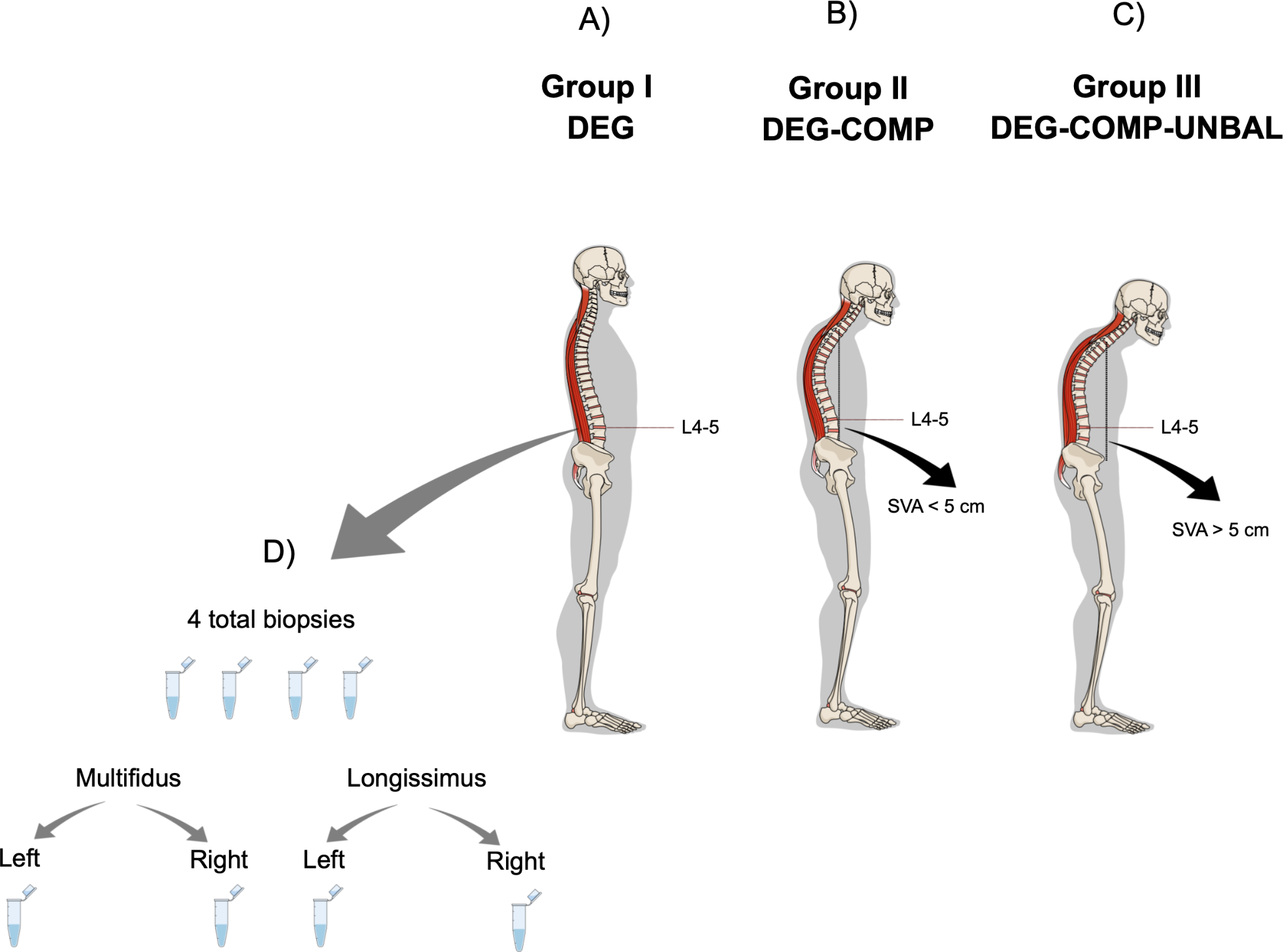 Paraspinal muscle fibre structural and contractile characteristics demonstrate distinct irregularities in patients with spinal degeneration and deformity