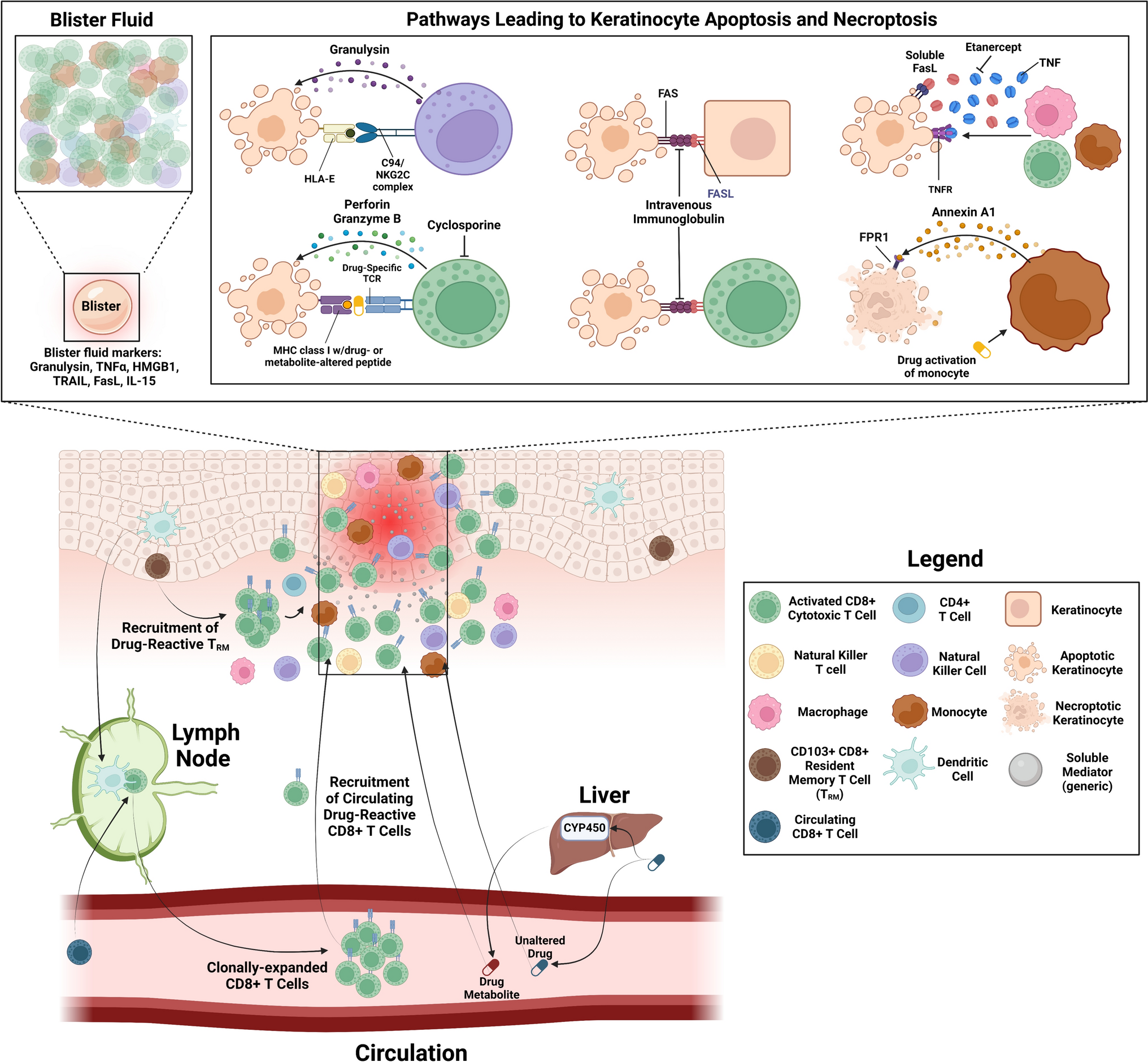 Update on Stevens–Johnson Syndrome and Toxic Epidermal Necrolysis: Diagnosis and Management