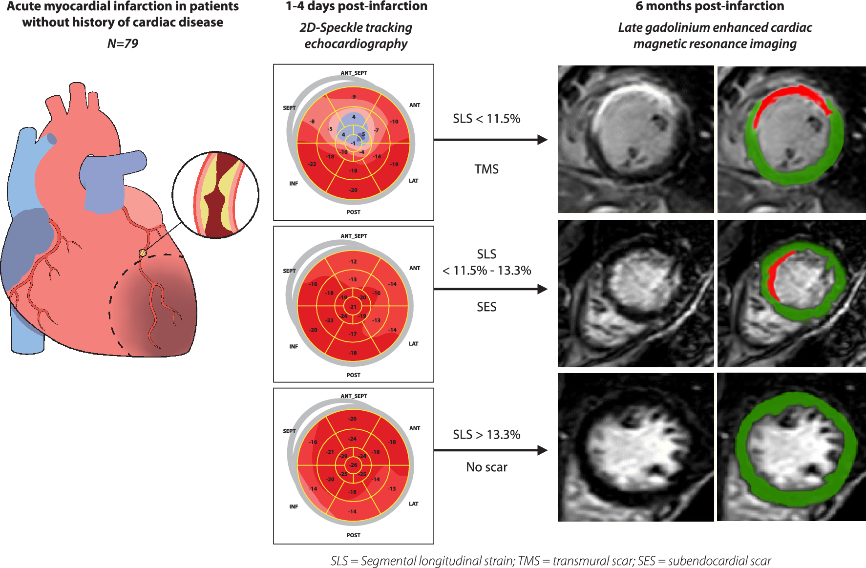 Global, segmental, and layer-specific two-dimensional speckle tracking echocardiography immediately after acute myocardial infarction as a predictive tool to assess myocardial viability and scar size