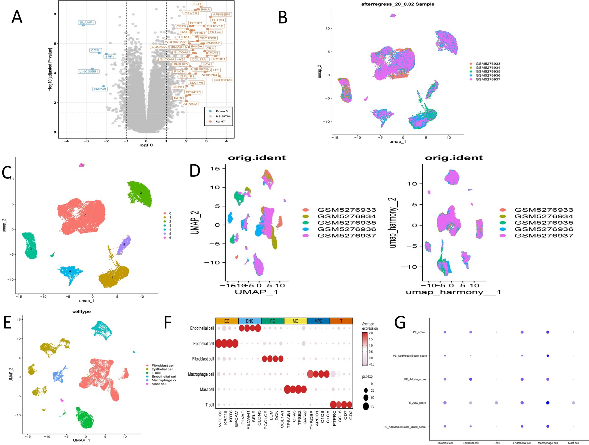 Identification of genetic and immune mechanisms linking preeclampsia and endometrial cancer: a prognostic model for survival and treatment response