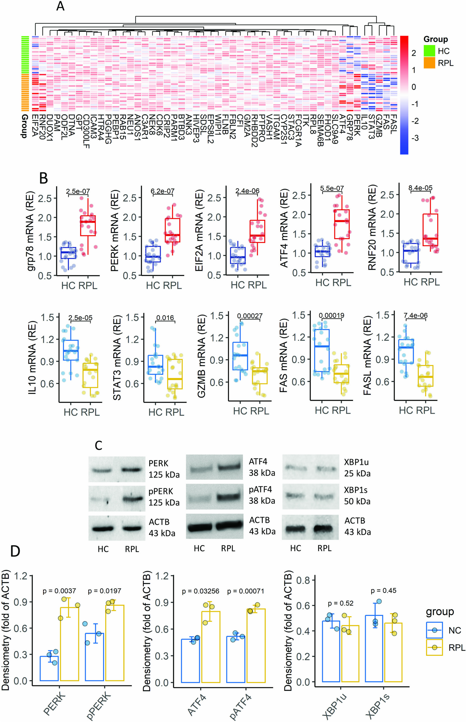 Impaired inducibility of immune regulatory capacity of peripheral B cells of patients with recurrent pregnancy loss