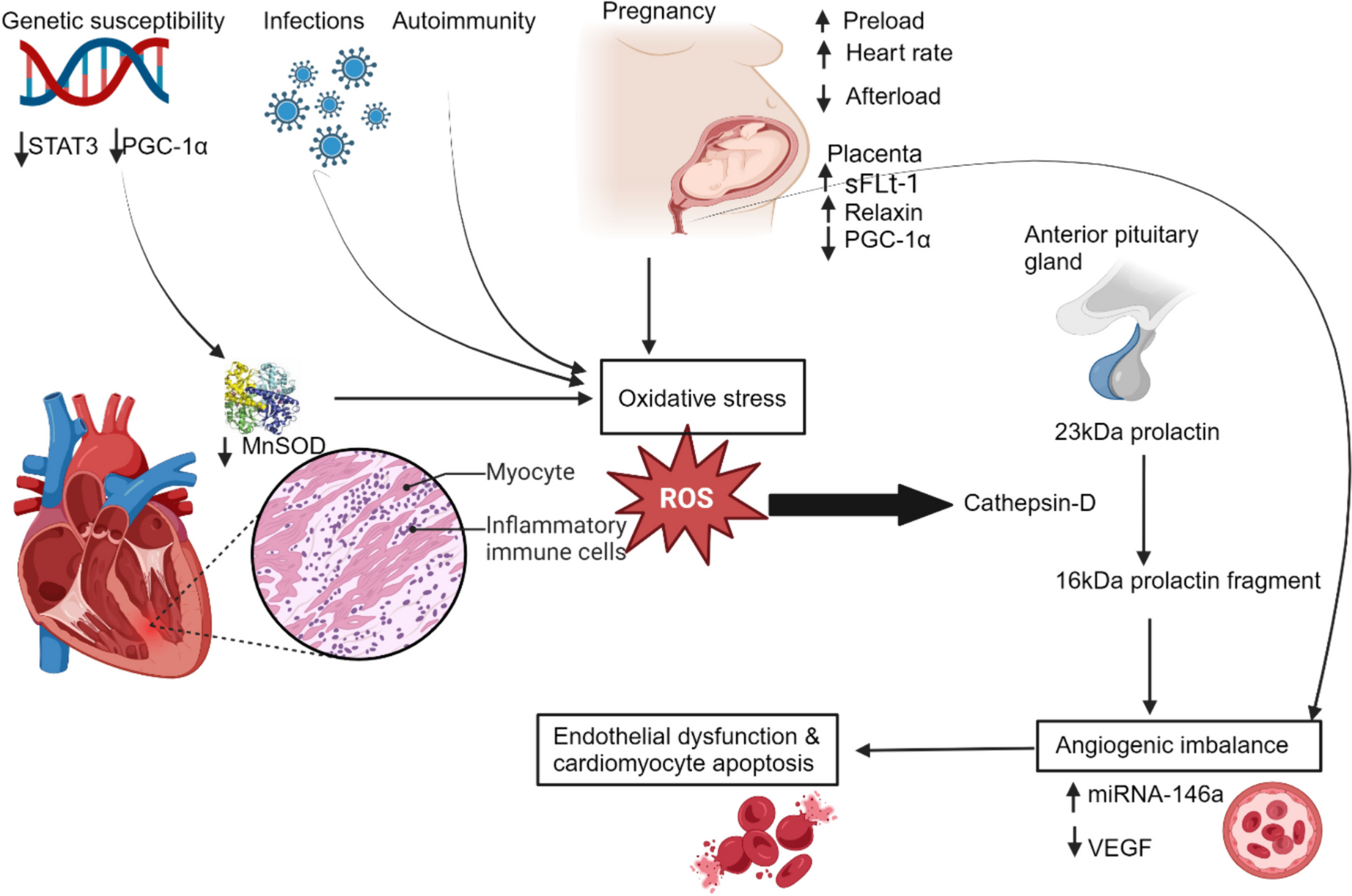 Peripartum cardiomyopathy: a comprehensive and contemporary review