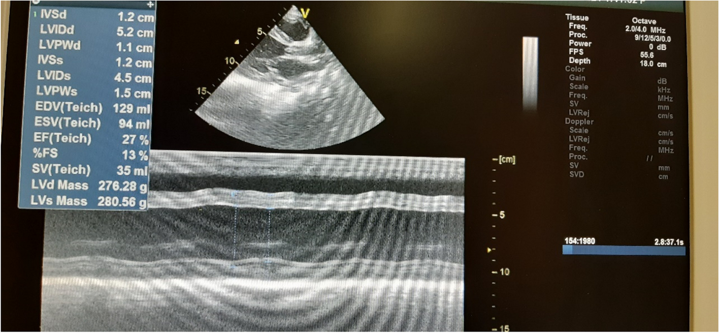 Congenital rubella syndrome and its protean manifestation in Nigeria