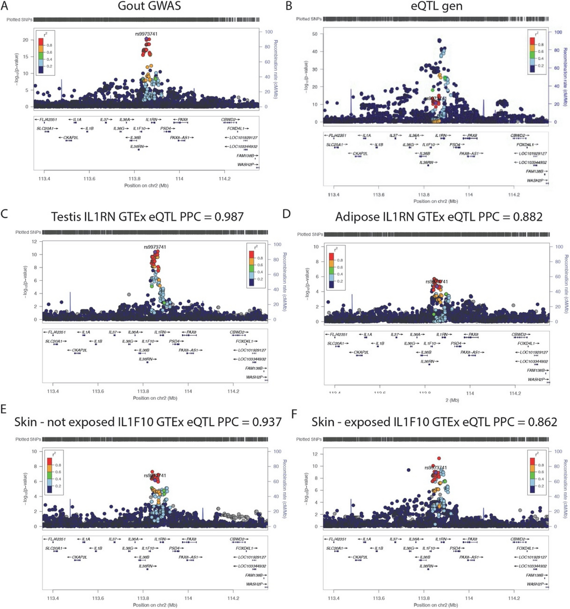 Gout-associated SNP at the IL1RN-IL1F10 region is associated with altered cytokine production in PBMCs of patients with gout and controls