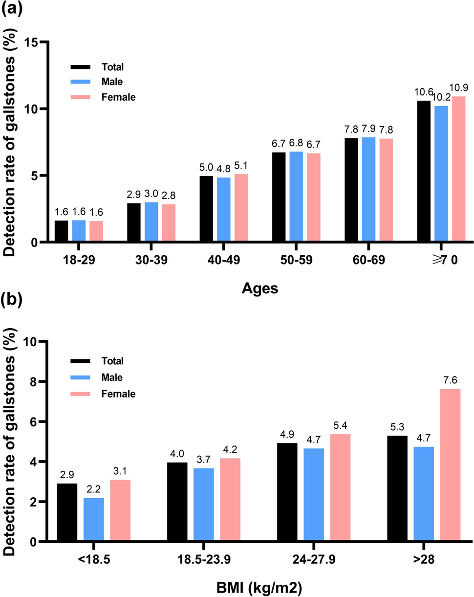 Metabolic abnormalities, liver enzymes increased risk of gallstones: a cross-sectional study and multivariate mendelian randomization analysis