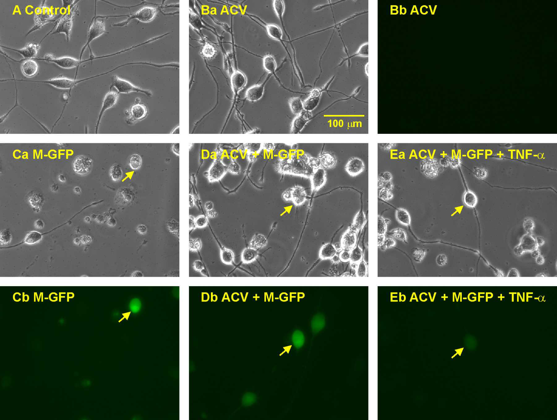 Regulation of voltage-gated sodium channels by TNF-α during herpes simplex virus latency establishment
