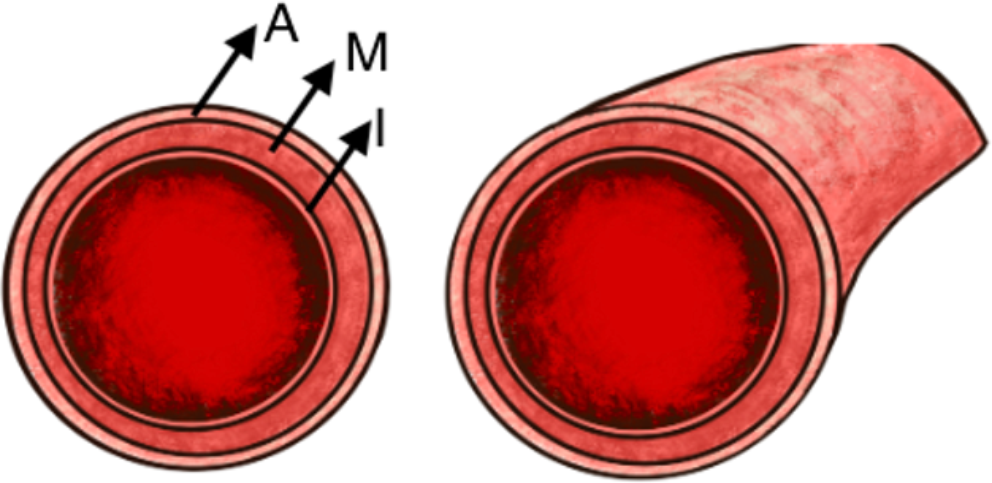 Multimodality imaging of coronary artery dissection: a pictorial essay