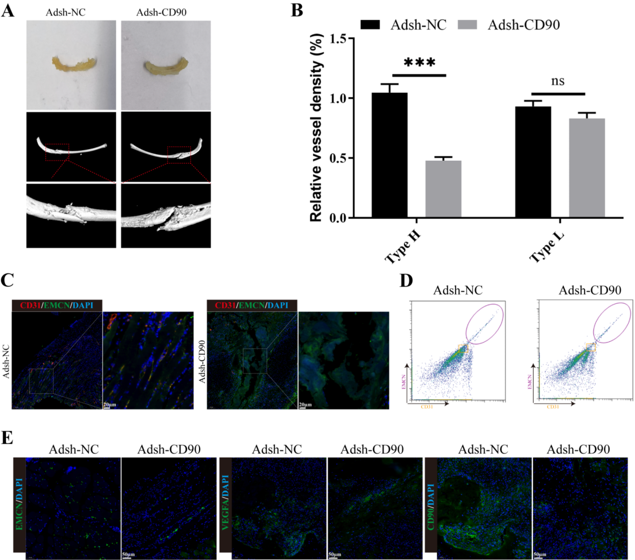 CD90’s role in vascularization and healing of rib fractures: insights from Dll4/notch regulation