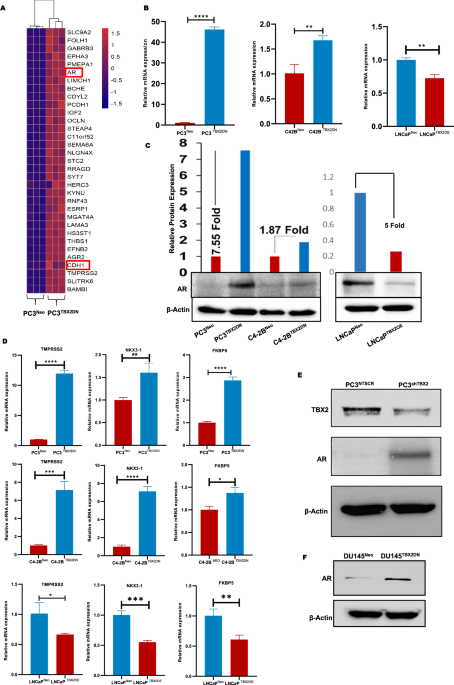A TBX2-driven signaling switch from androgen receptor to glucocorticoid receptor confers therapeutic resistance in prostate cancer