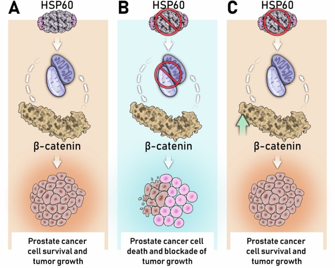 Mitochondrial unfolded protein response-dependent β-catenin signaling promotes neuroendocrine prostate cancer