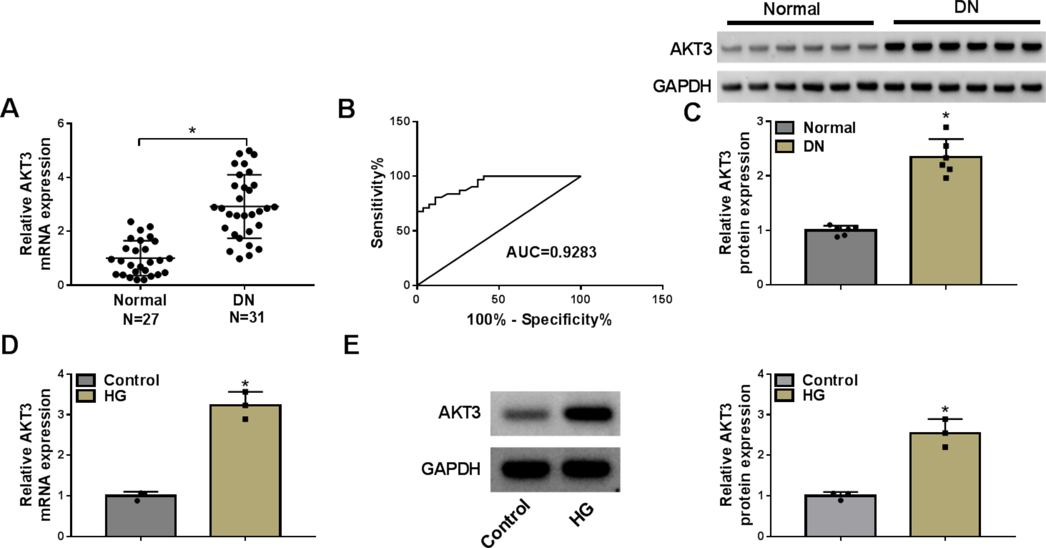 SP1 activates AKT3 to facilitate the development of diabetic nephropathy