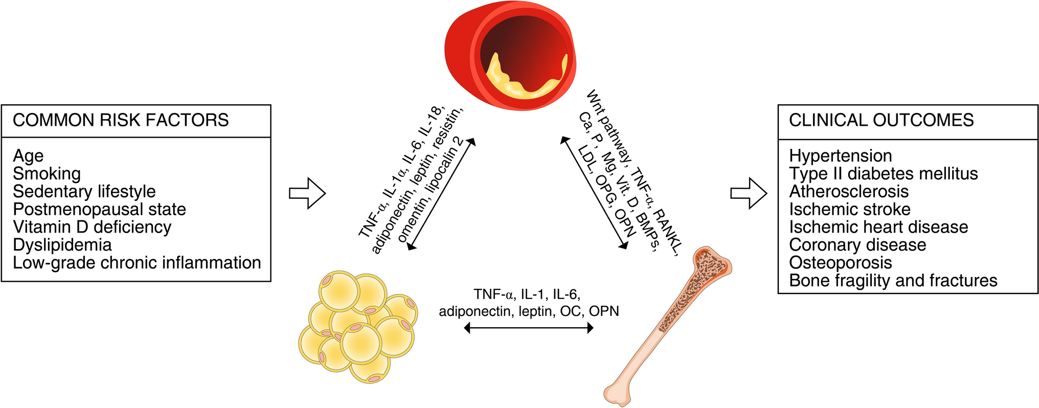 An integrated view of the pathophysiological crosstalk between adipose tissue, bone and cardiovascular system in men and women