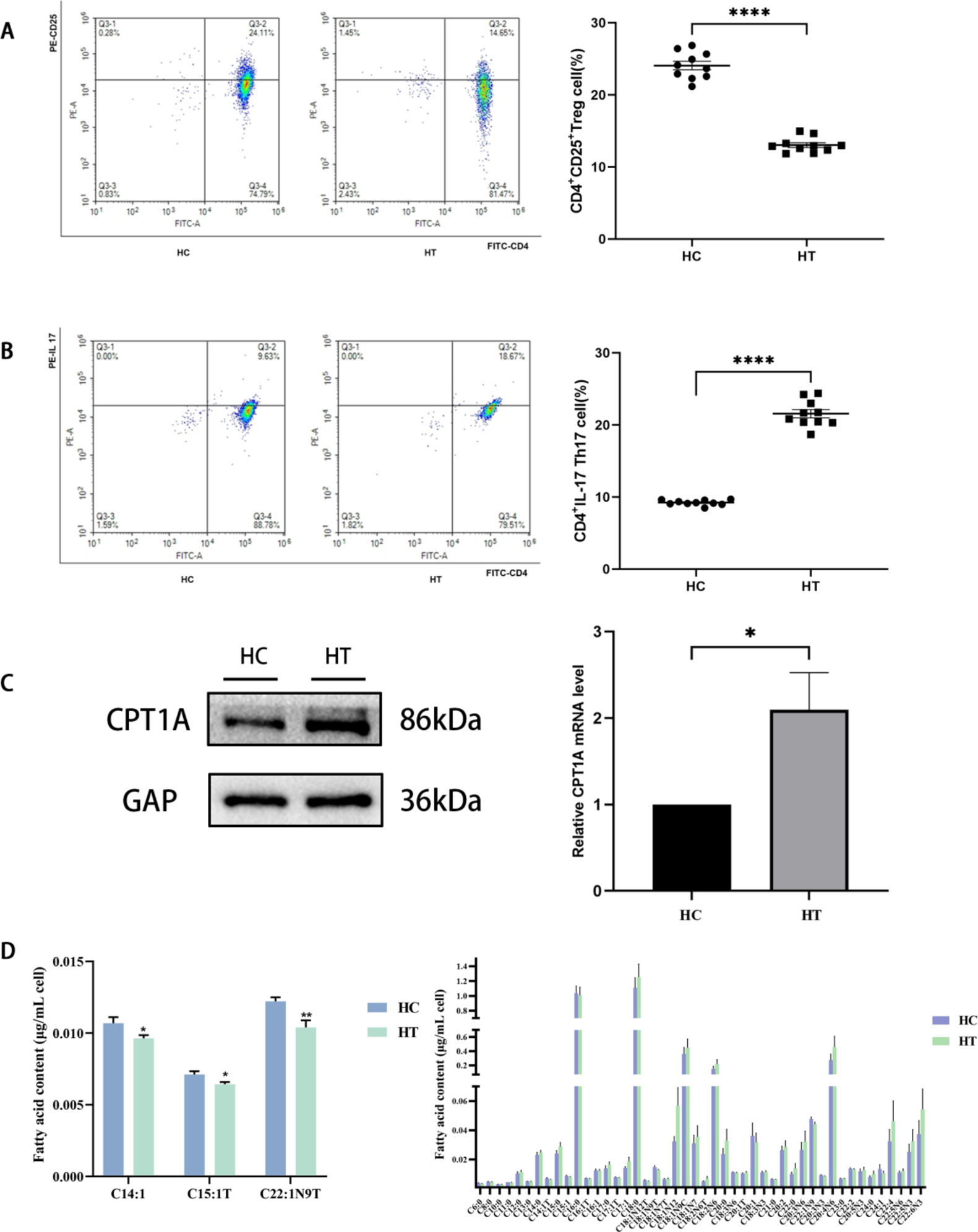 The immune mechanism of the mTOR/ACC1/CPT1A fatty acid oxidation signaling pathway in Hashimoto’s thyroiditis