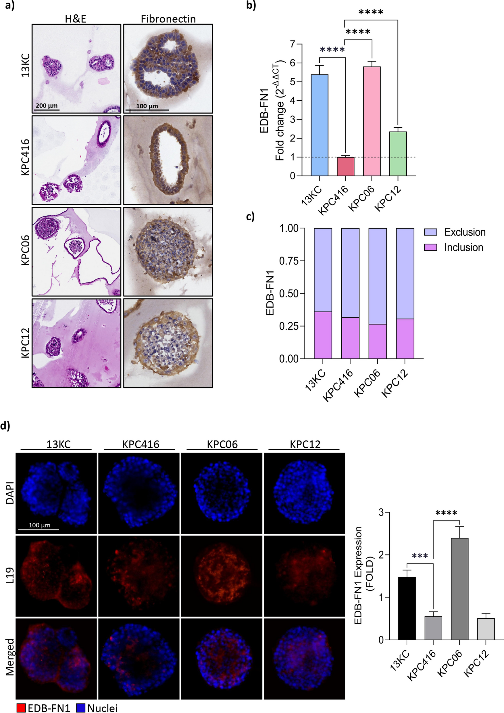 Antibody-based delivery of interleukin-2 modulates the immunosuppressive tumor microenvironment and achieves cure in pancreatic ductal adenocarcinoma syngeneic mice