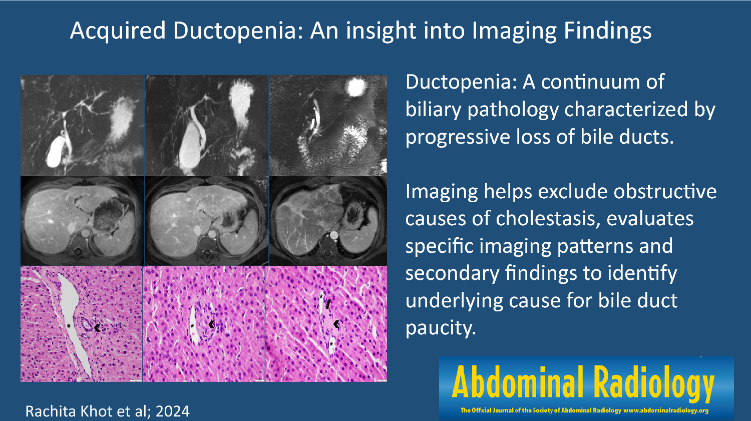 Acquired ductopenia: an insight into imaging findings