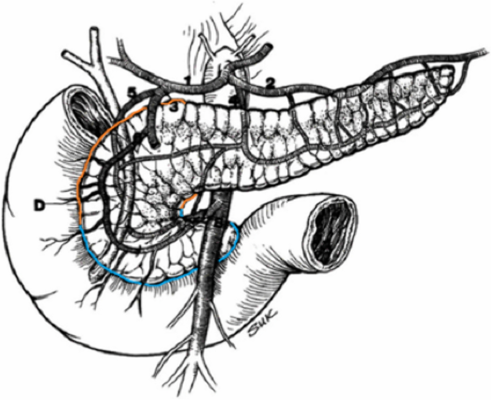 A head with two tales: demystifying early spread of disease from the pancreatic head