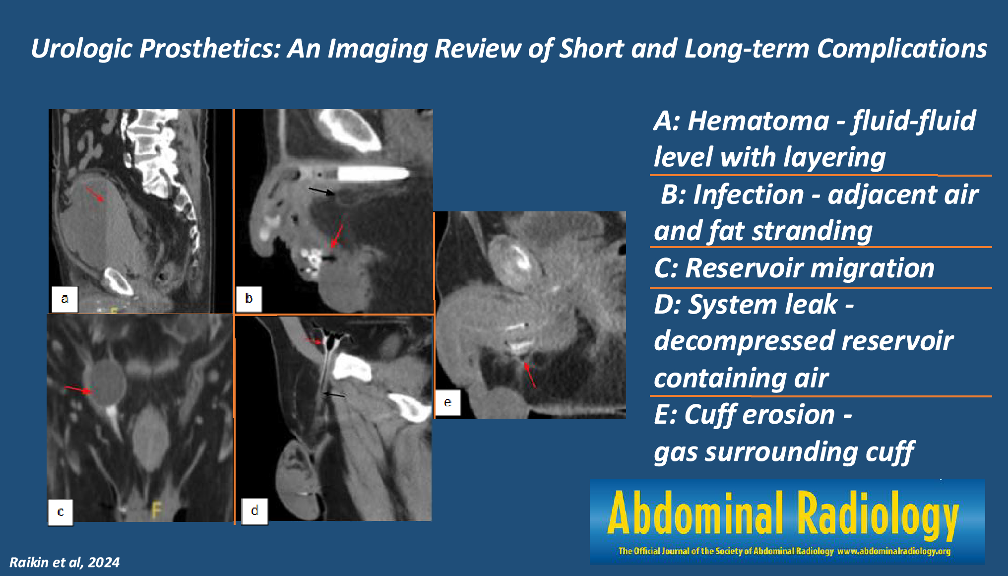 Urologic prosthetics: an imaging review of short- and long-term complications